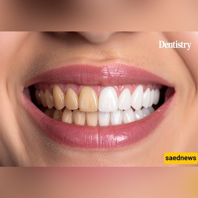 هل تعلم أن تنظیف أسنانک وحده لا یکفی؟ هذه الأخطاء تحرمک من الابتسامه المثالیه