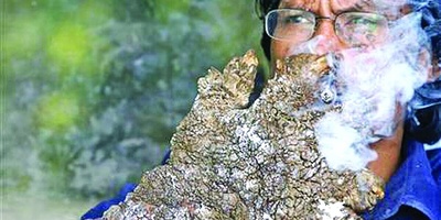 اکتشاف کائن غریب نصفه إنسان ونصفه شجره — سبحان الله! [صور]