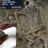 اکتشاف مذهل: ید صناعیه عمرها 500 عام