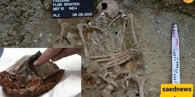 اکتشاف مذهل: ید صناعیه عمرها 500 عام