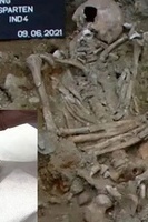 اکتشاف مذهل: ید صناعیه عمرها 500 عام