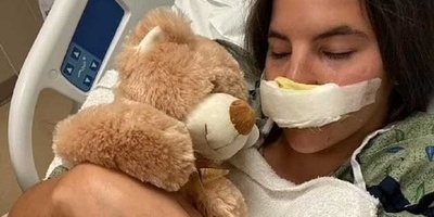 القصه الصادمه لعارضه شابه تمزق شفاهها على ید کلب بیتبول