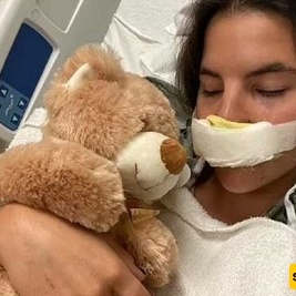 القصه الصادمه لعارضه شابه تمزق شفاهها على ید کلب بیتبول