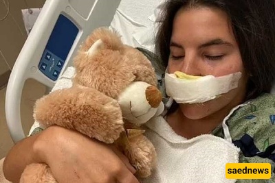 القصه الصادمه لعارضه شابه تمزق شفاهها على ید کلب بیتبول