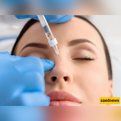 حقن فیلر الأنف بدل الجراحه.. هل أصبح الطریق الأسرع لتغییر شکل الأنف؟