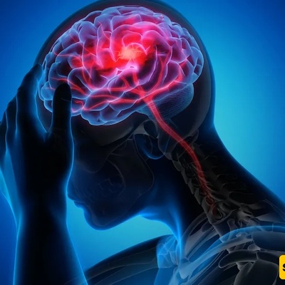العلامات المبکره للسکته الدماغیه التی غالبًا ما یتم تجاهلها