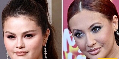 سیلینا غومیز تصالح مع متبرع کلیتها