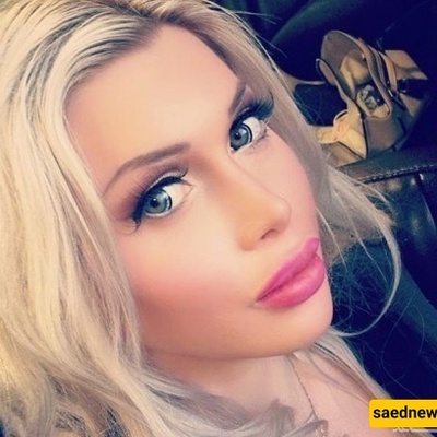 جراحات قصوى لامرأه لتحقیق أصغر خصر فی العالم