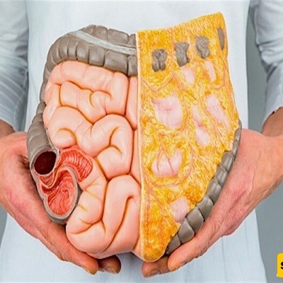 نظّف أمعاءک وادعم إداره الوزن باستخدام هذه الخلطات والخضروات الطبیعیه